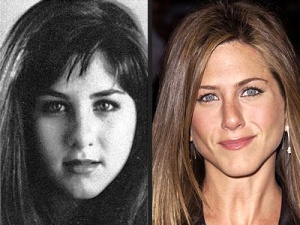 Chirurgie de star: Jennifer Aniston