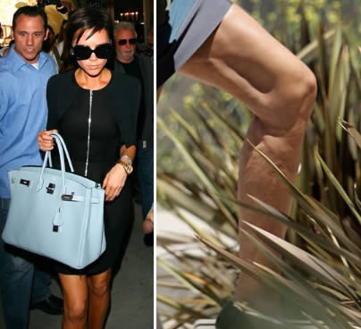 Stars avec cellulite: Victoria Beckham et cellulite