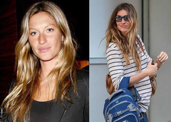 Gisele Bndchen: Chirurgie esthtique de star