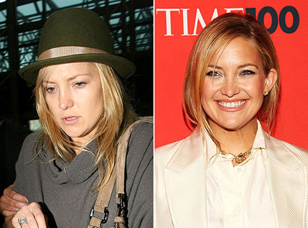 Stars sans maquillage : Kate Hudson sans maquillage 