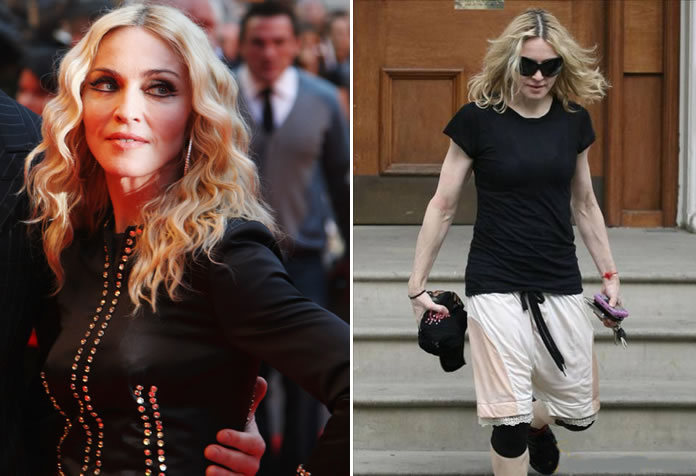 Régime de star: régime Madonna