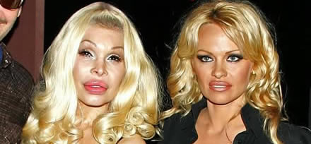 Chirurgie de star: Pamela Anderson et Amanda Lepore